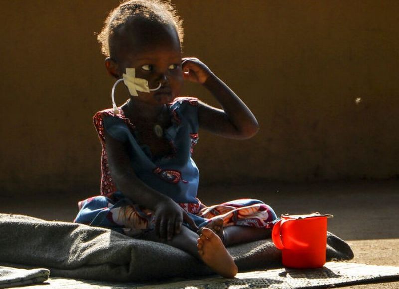 UNICEF: «Καταστροφικά» επίπεδα παιδικού υποσιτισμού λόγω της αύξησης στις τιμές των τροφίμων