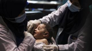 Δείτε το μωράκι που ανασύρθηκε από τα ερείπια μετά από βομβαρδισμό που σκότωσε 10 μέλη της οικογένειάς του